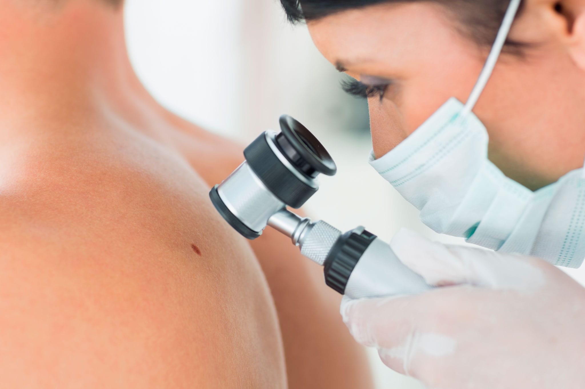 Médica dermatologista examina uma lesão de pele com o dermatoscópio